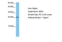 SSR3 Rabbit anti-Human, Polyclonal, Novus Biologicals 0.1ml; Unconjugated:Antibodies,